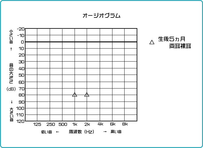 オージオグラム