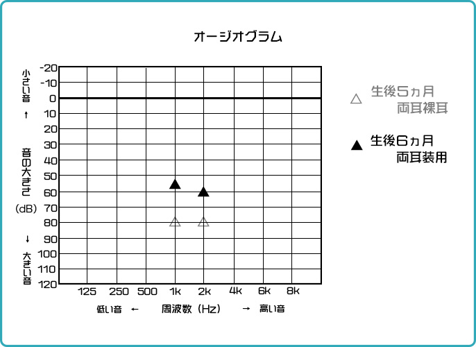 オージオグラム