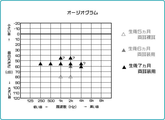 オージオグラム