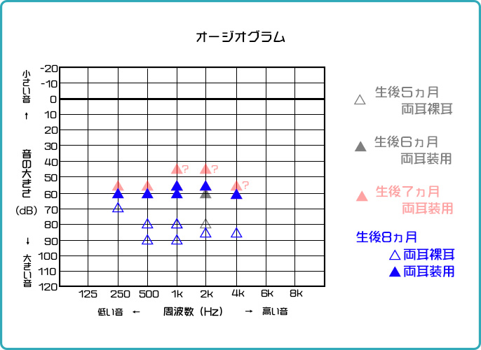 オージオグラム８カ月