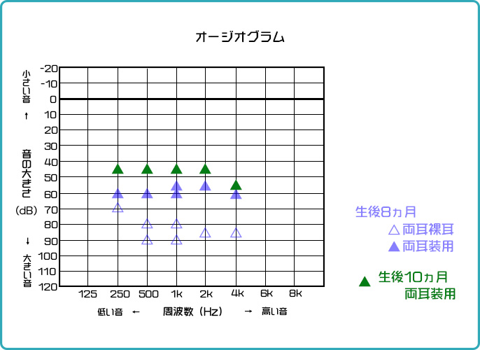 オージオグラム