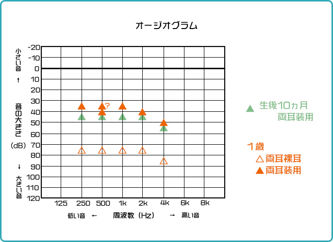 １歳の時のオージオグラム