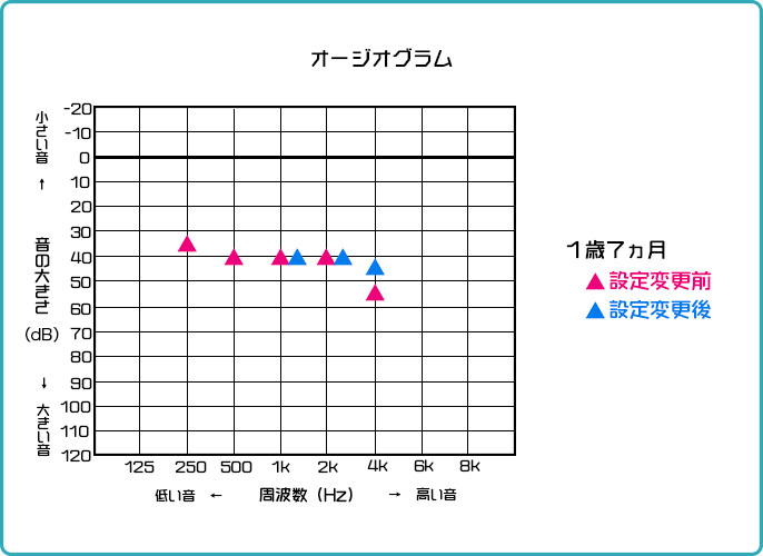 オージオグラム