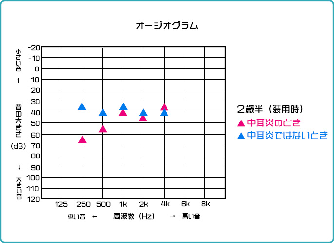 オージオグラム（２歳半）